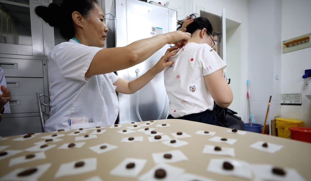 A doctor practices sanfutie treatment on a patient in Jinan, Shandong province, in July 2018. Photo: Xinhua