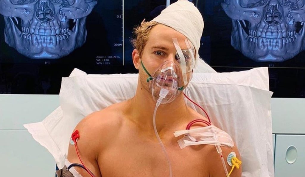 Sage Northcutt’s facial injuries shocked the MMA world in May. Photo: Instagram