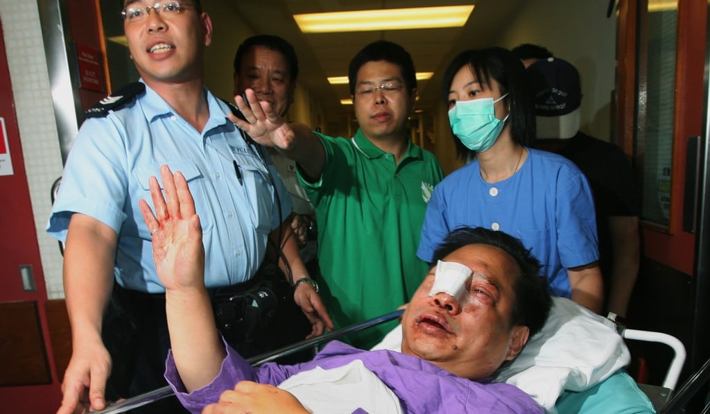 Albert Ho was also attacked in 2006 and suffered head, arm and facial injuries. Photo: Martin Chan