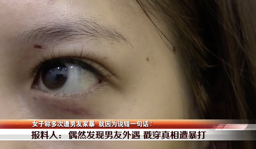 Video of the attack on Tang appeared online on Sunday after a TV report on the incident. Photo: Weixin