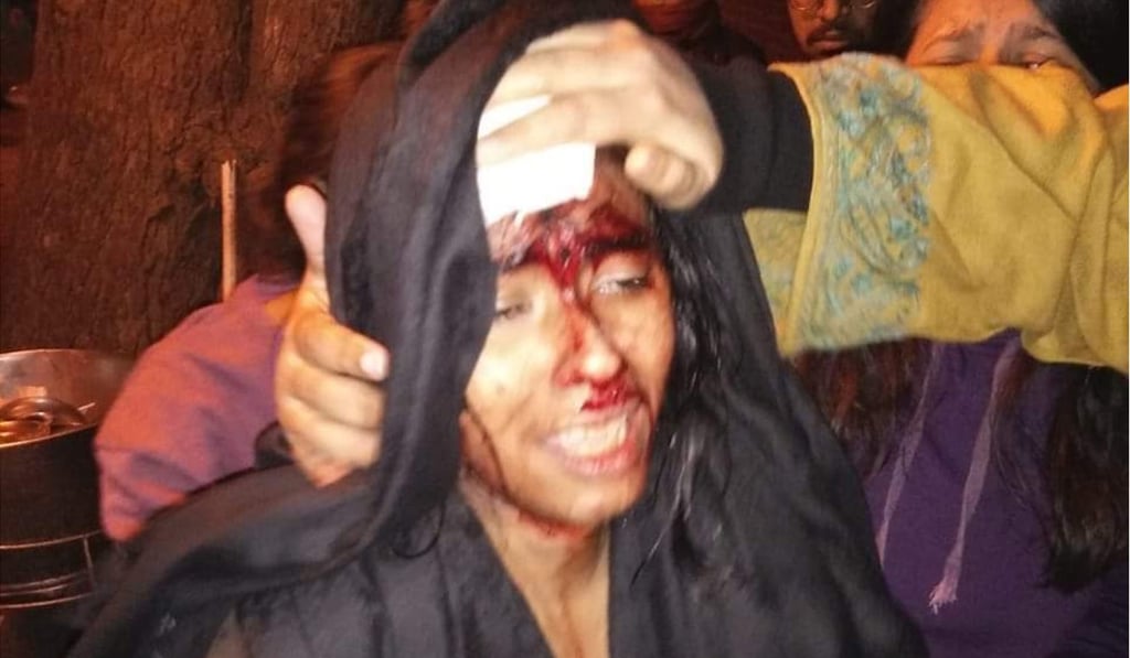 Aishe Ghosh, president of Jawaharlal Nehru University's student union, is seen bleeding after the attack. Photo: Twitter Aishe Ghosh, president of Jawaharlal Nehru University's student union, is seen bleeding after the attack. Photo: Twitter