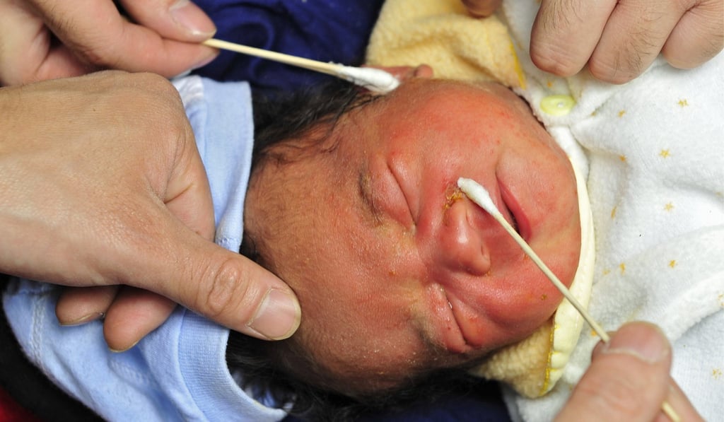 A 13-day-old baby survivor of the May 12, 2008, earthquake in Wenchuan, Sichuan, receives treatment five days later. Billions of dollars that had been donated after the disaster were mishandled, but has the lesson been learned? Photo: AFP
