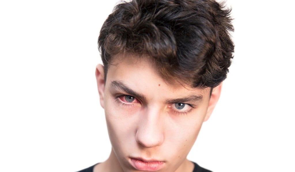 Keep your hands away from your eyes to prevent yourself from getting some nasty bugs