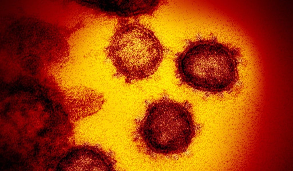 An electron microscope image showing the coronavirus at the US National Institutes of Health. Photo: AP