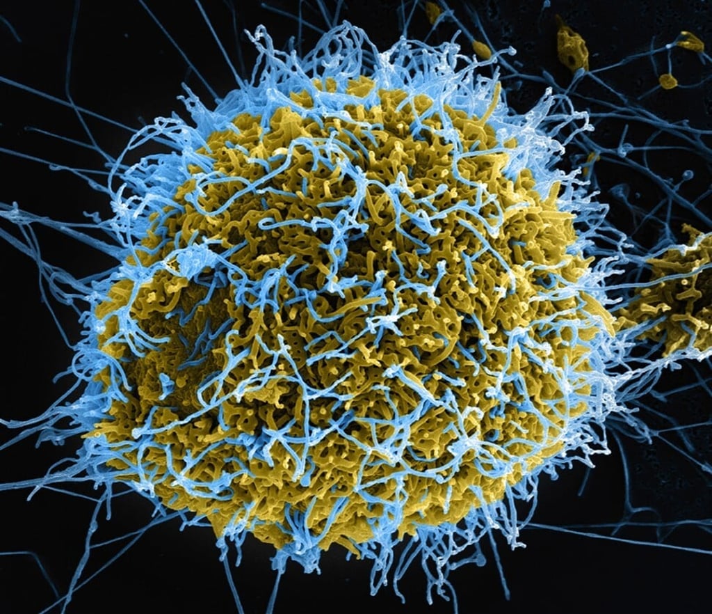 Ebola virus particles (blue) budding from an infected VERO E6 cell. Photo: Getty Images
