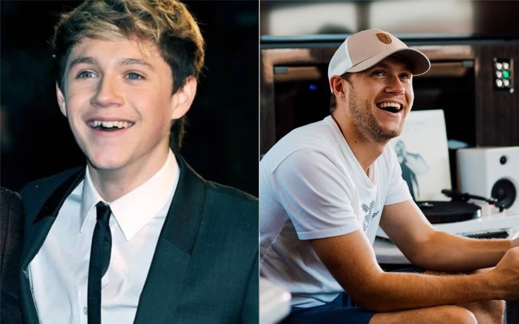Niall Horan, before and after braces. Photo: Luxurylaunches/Instagram Niall Horan, before and after braces. Photo: Luxurylaunches/Instagram