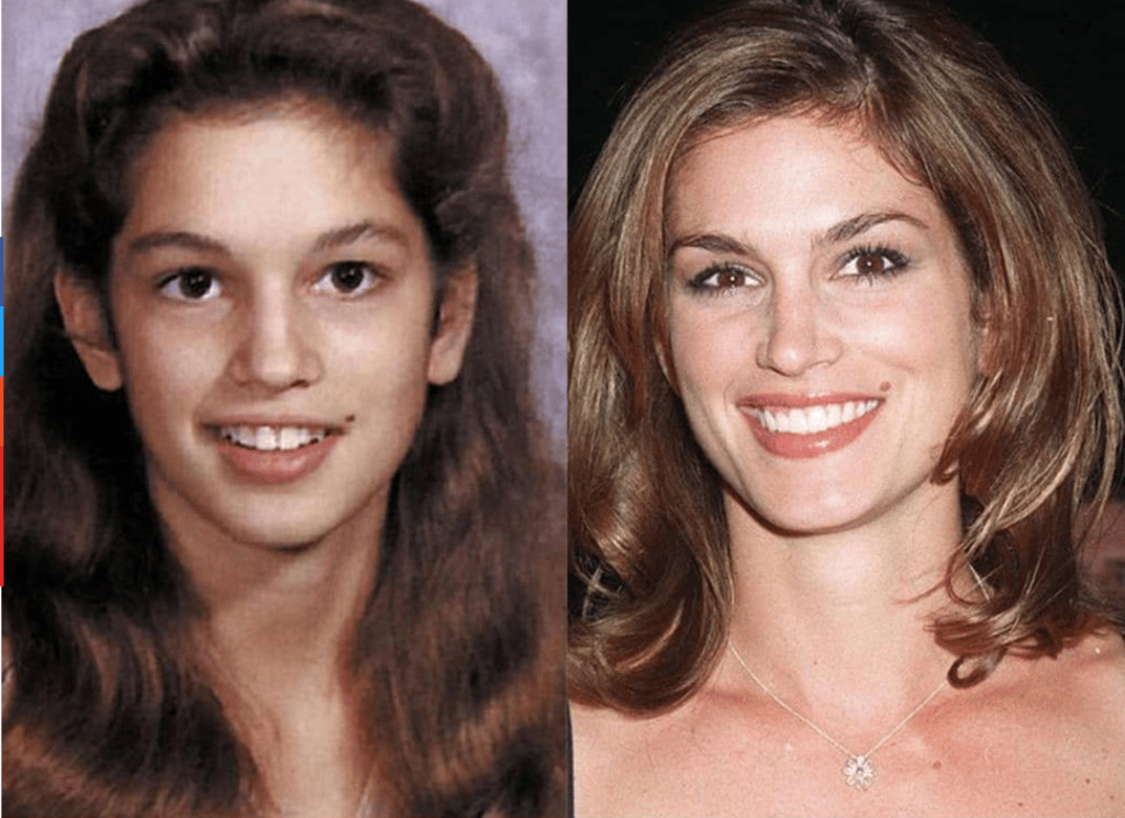 Cindy Crawford, before and after braces. Photo: Luxurylaunches