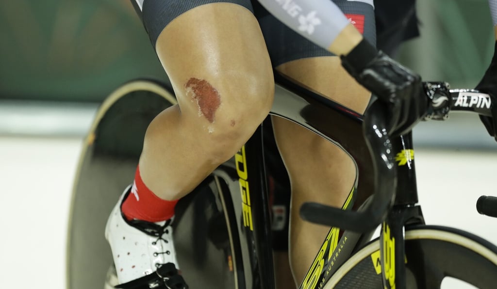 A graze on the knee of Sarah Lee as she competes in the sprint quarter-finals at the Rio Olympics. Photo: AP