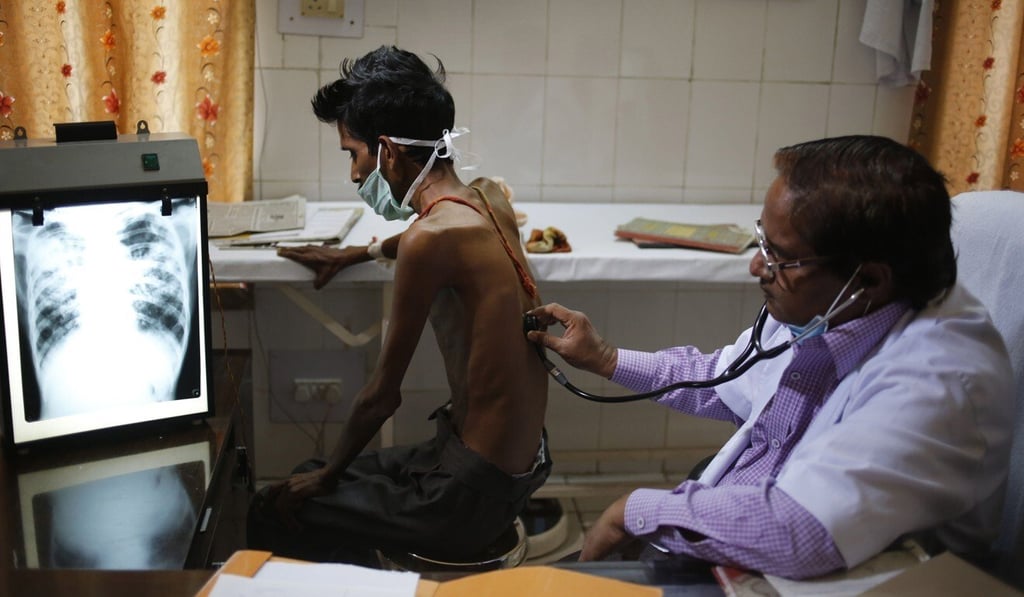 A doctor examines a tuberculosis patient in a government hospital in India, in this 2014 file photo. Photo: AP