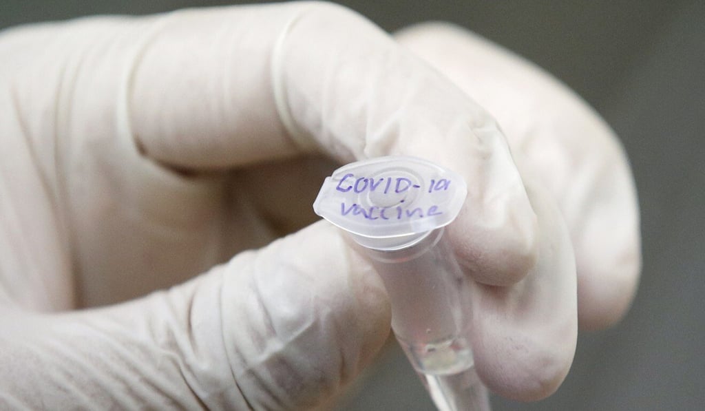 A Thai medical technician tests a Covid-19 vaccine prototype at a laboratory in Bangkok. Photo: EPA