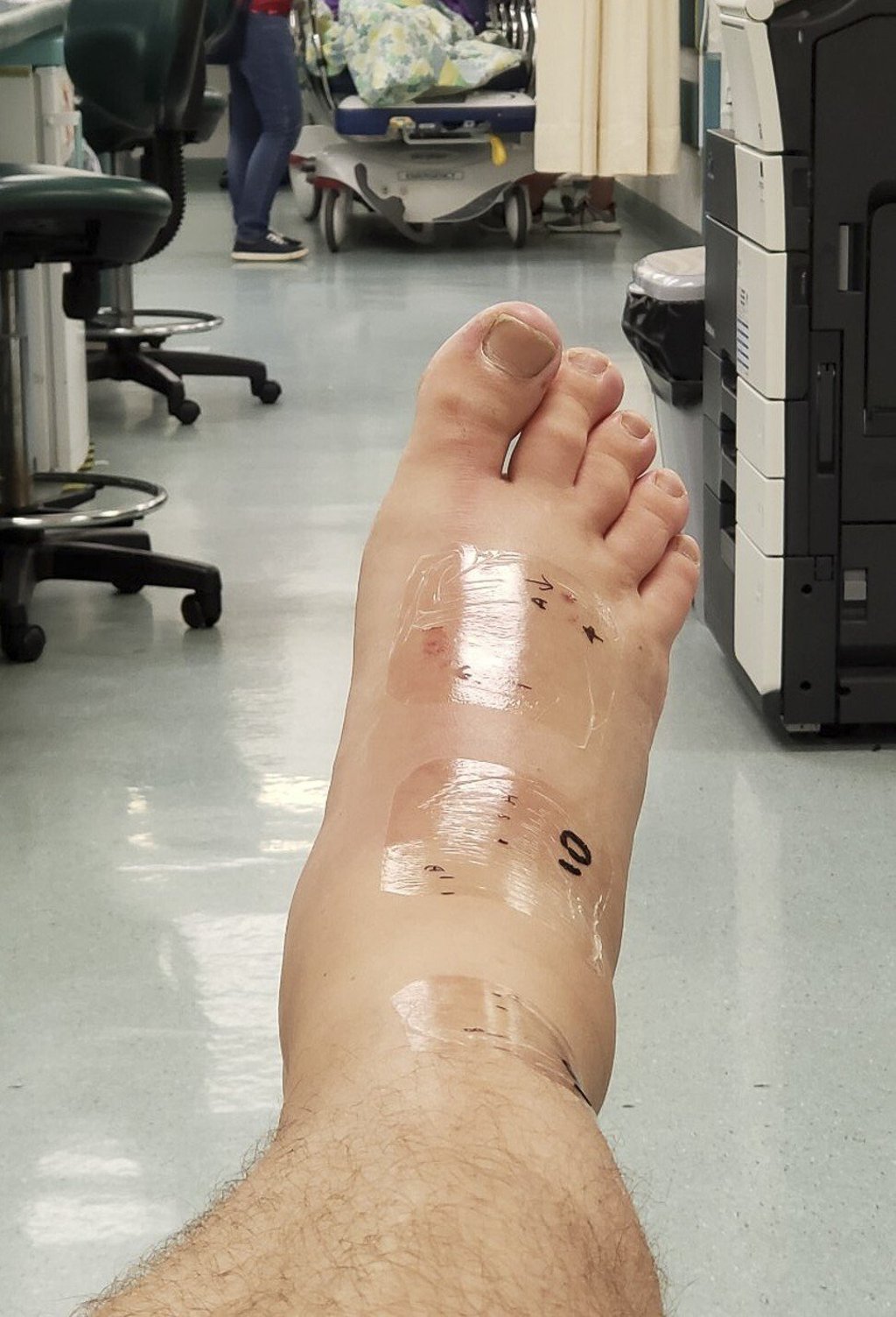 Steve Pheby knew which species of snake had bitten him, valuable information which helped with his treatment. Photo: courtesy of Steve Pheby