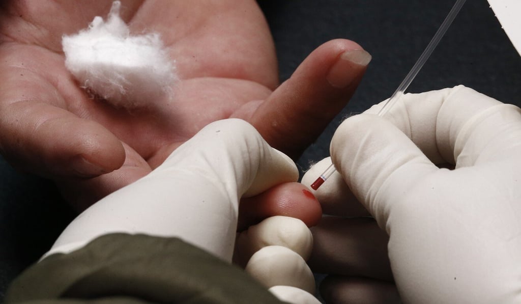 A blood sample is collected for coronavirus testing from a person in Metro Manila earlier this month. Photo: EPA