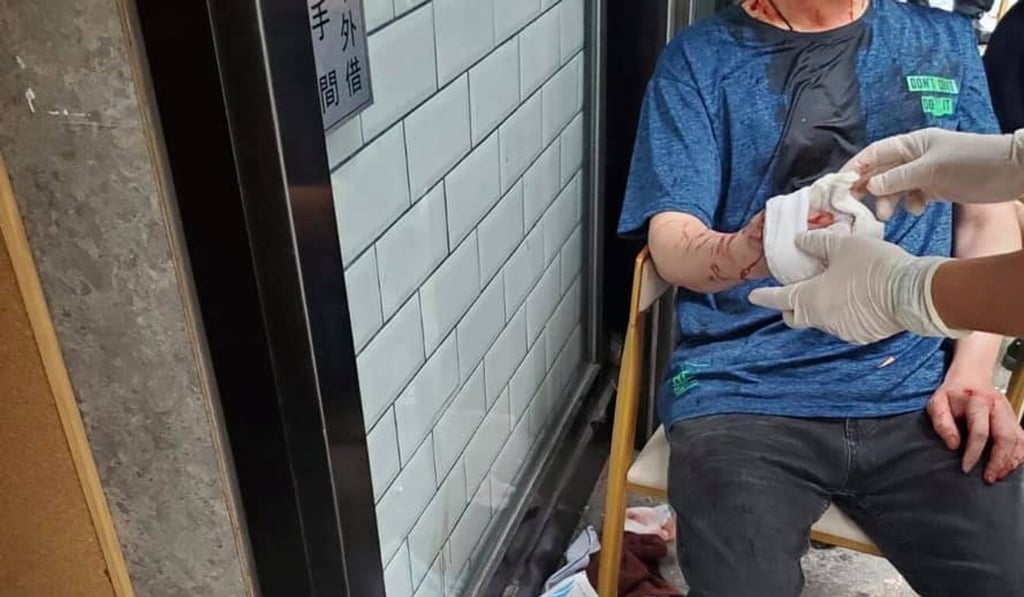 A chef was attacked outside Lung Mun Cafe in Hong Kong’s Tsim Sha Tsui neighbourhood on early Monday morning. Photo: Lung Mun Cafe Facebook