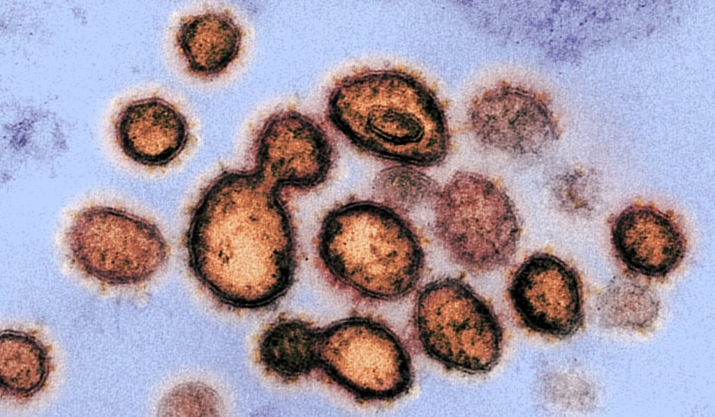 When the human body comes under attack from a virus, the immune system produces T cells to tackle it. Pictured are coronavirus particles, seen via transmission electron microscope. The spikes around the virus particles give them their name, “crown-like”. Photo: National Institiutes of Health handout via NIAID- RML/EPA-EFE