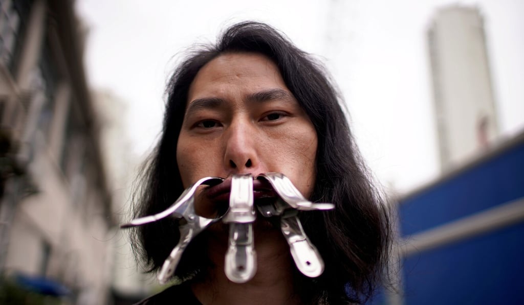 The artist used metal clasps and other items to seal his mouth in the 30-day project. Photo: Reuters