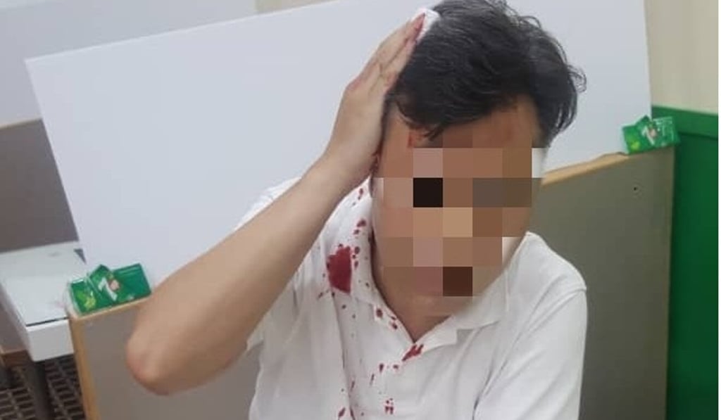 The 46-year-old owner of Jade Restaurant on Sai Yu Street in Yuen Long was attacked on Thursday, the second time he has been assaulted in a month. Photo: Facebook The 46-year-old owner of Jade Restaurant on Sai Yu Street in Yuen Long was attacked on Thursday, the second time he has been assaulted in a month. Photo: Facebook