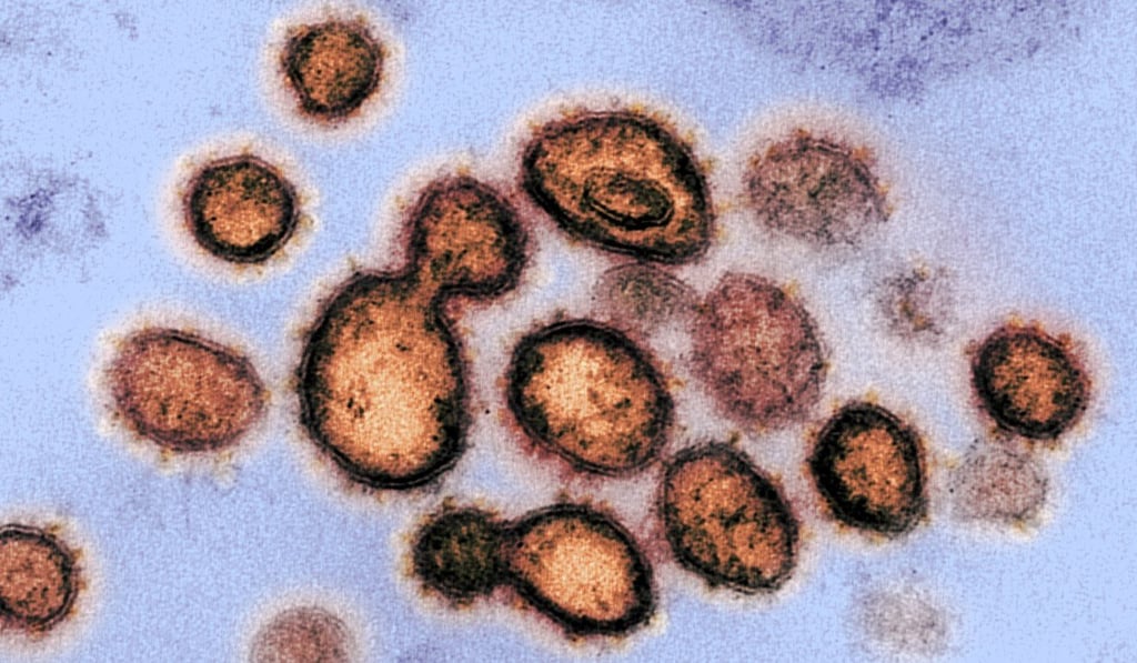 Studies suggest certain immune cells involved in the defence against the common cold also react when exposed to SARS-CoV-2 (pictured). Photo: EPA-EFE Studies suggest certain immune cells involved in the defence against the common cold also react when exposed to SARS-CoV-2 (pictured). Photo: EPA-EFE