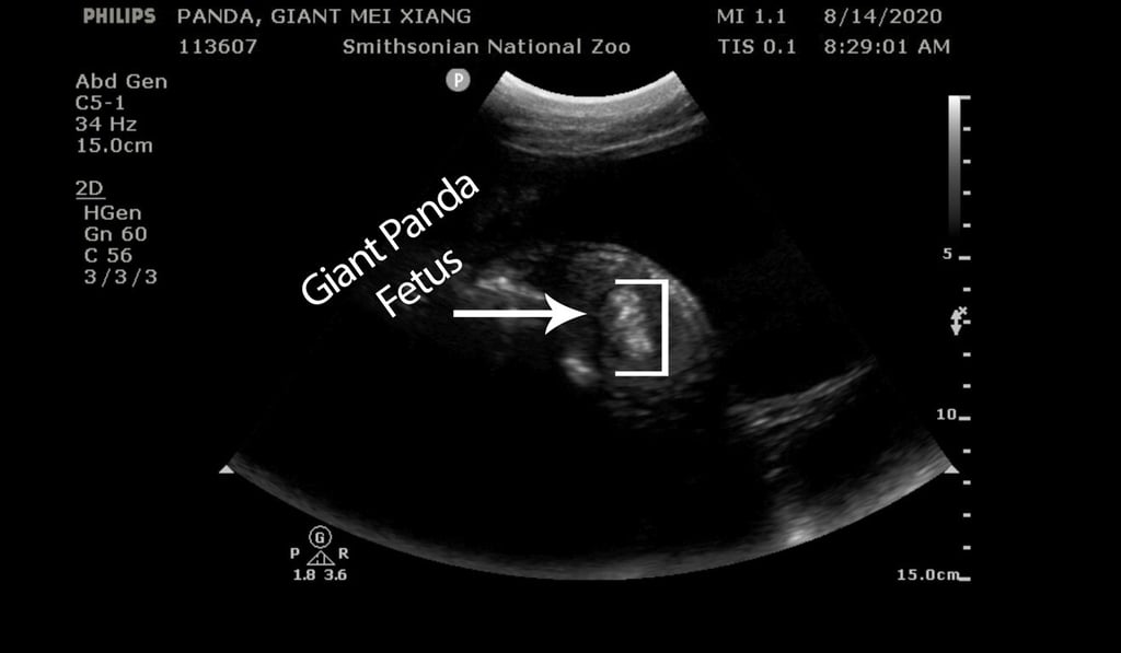 Zoo veterinarians saw the fetus kicking and swimming during giant panda Mei Xiang’s ultrasound at the National Zoo on Monday. Photo: Smithsonian's National Zoo handout via AFP
