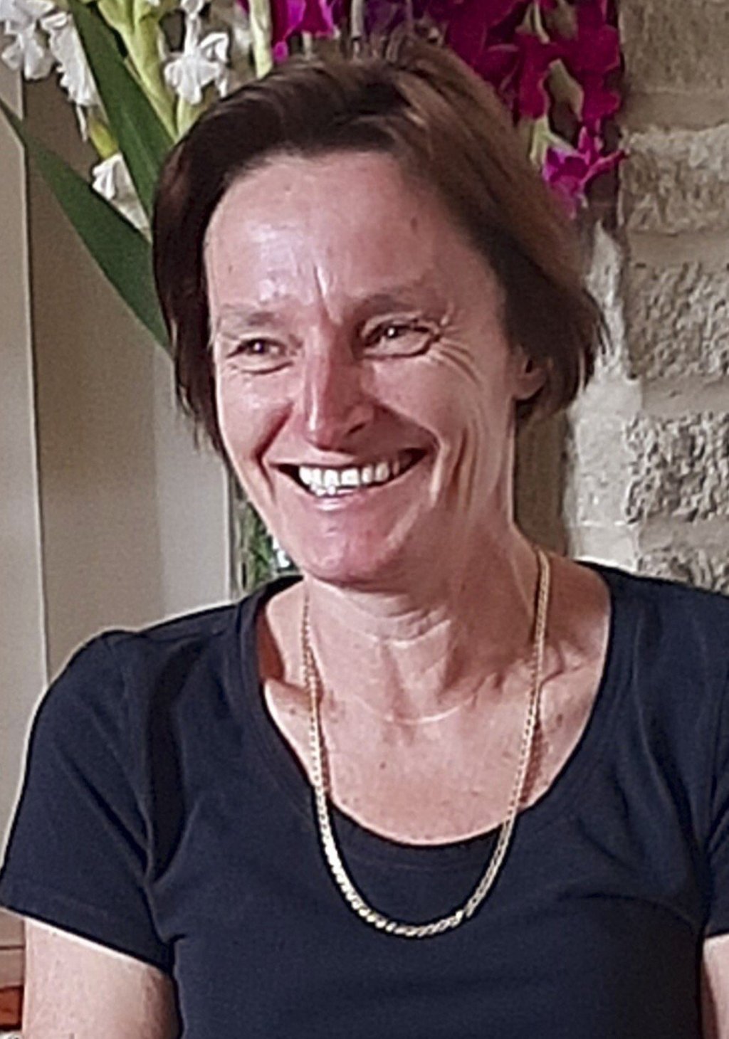 Carol Wilson had nodules in her thyroid gland in her mid-20s, and had half the gland removed. Carol Wilson had nodules in her thyroid gland in her mid-20s, and had half the gland removed.