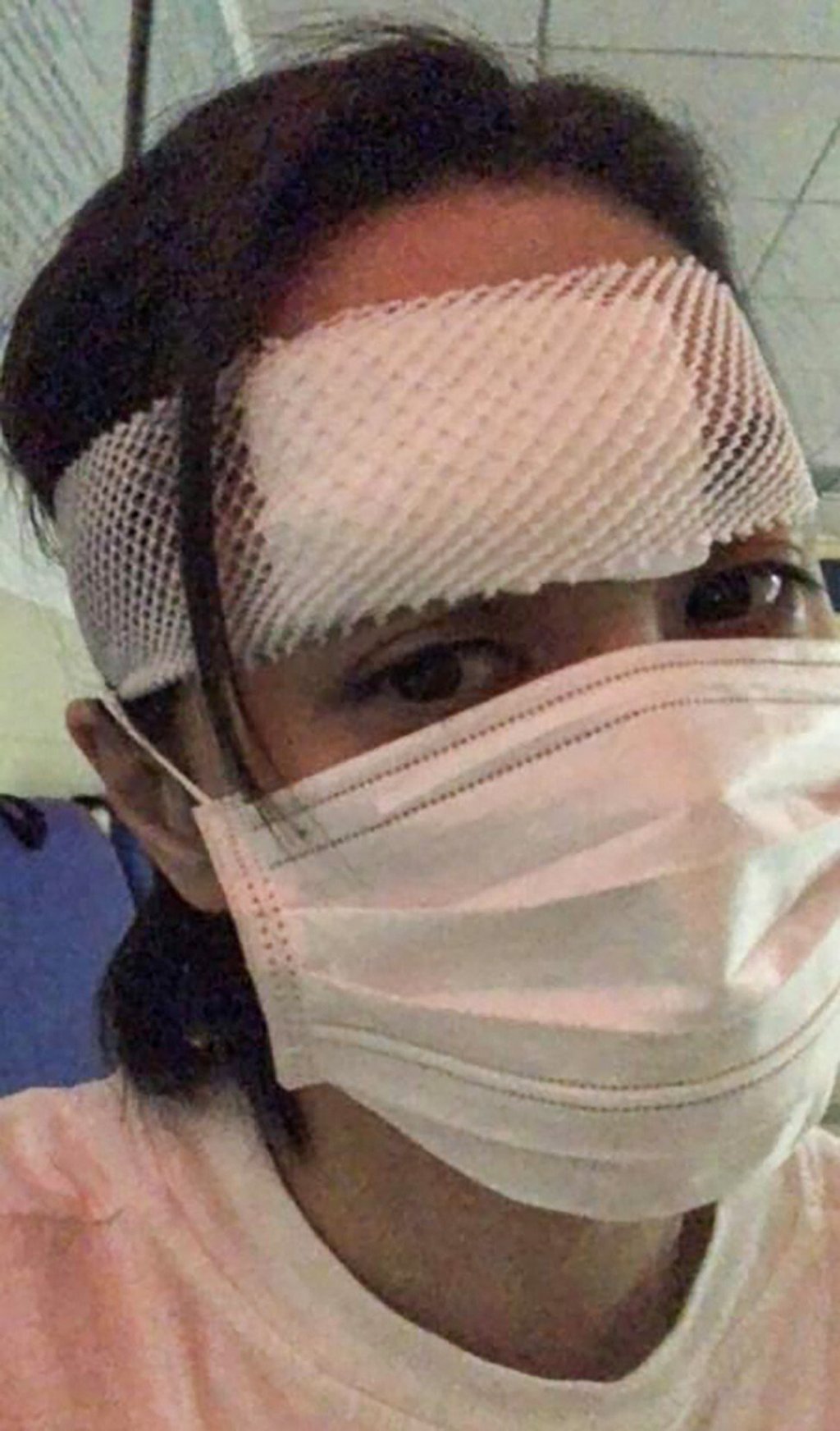Gillian Chung needed 10 stitches for the injury to her forehead. Photo: Weibo