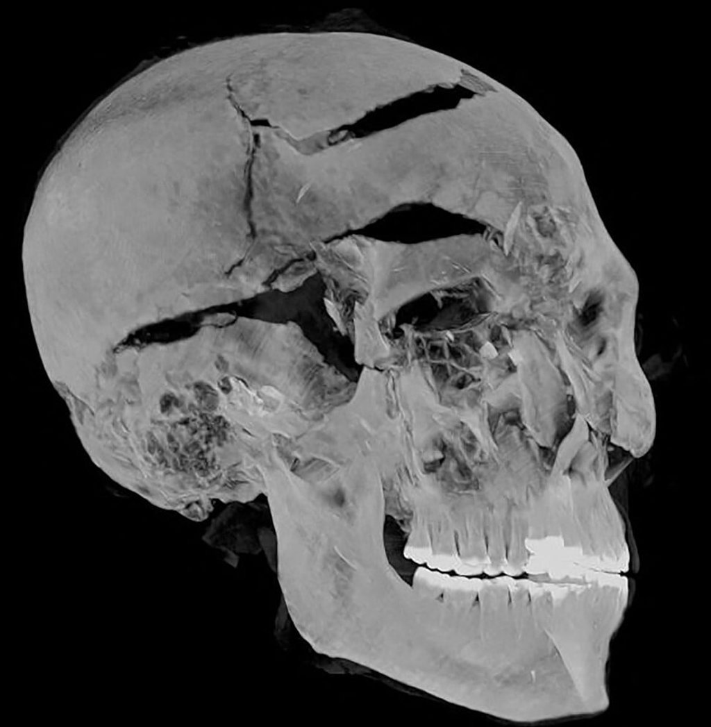 A computed tomography scan was performed on the mummy of ancient Egyptian pharaoh Seqenenre Tao II. Image: Egyptian Ministry of Antiquities via AFP