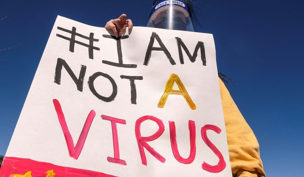 A rally near Chinatown in Los Angeles, California on February 20 to raise awareness of anti-Asian violence. Photo: AFP
