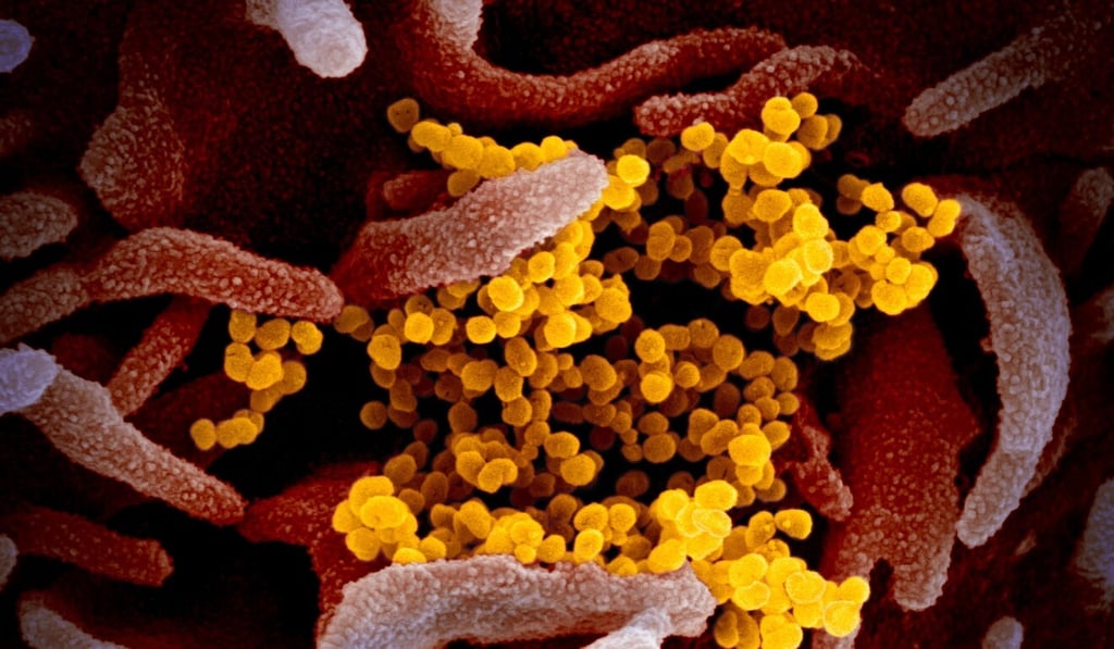 Some who have been infected by the coronavirus can still feel its effects months down the road, a phenomenon that has been dubbed ‘long Covid’. Photo: EPA-EFE