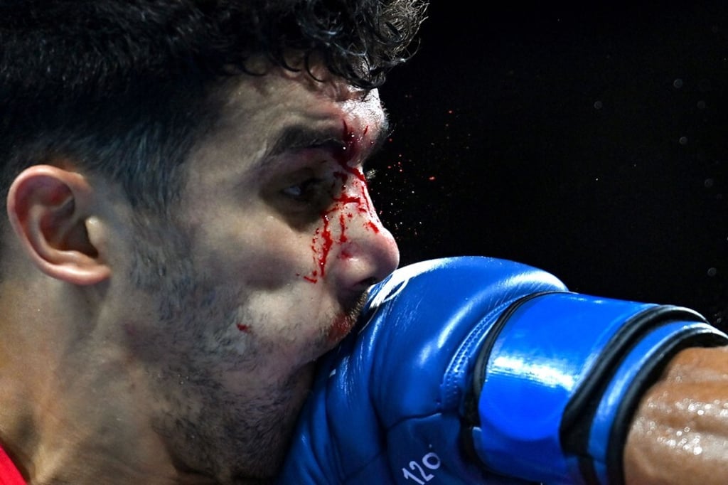 Algeria’s Younes Nemouchi bleeds as he takes a punch from Philippines' Eumir Marcial. Photo: AFP Algeria’s Younes Nemouchi bleeds as he takes a punch from Philippines' Eumir Marcial. Photo: AFP