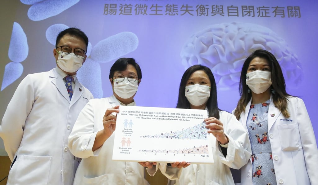 The Chinese University team: (from left) Professor Francis Chan, Dr Dorothy Chan, Dr Sandra Chan Sau-man and Professor Ng Siew-chien. Photo: Edmond So