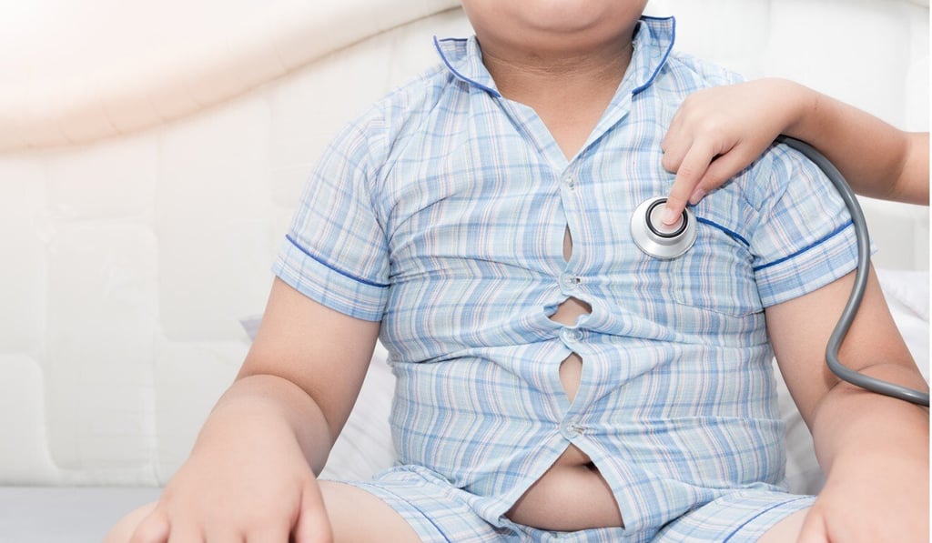 Obesity in children can lead to health problems in the future. Photo: Shutterstock Obesity in children can lead to health problems in the future. Photo: Shutterstock