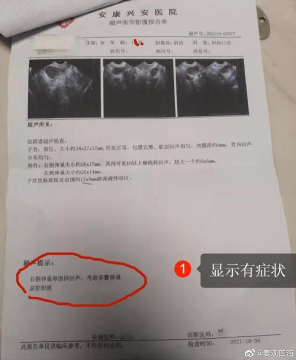 The girl’s parents claim she was presented with a large bill after the surgery and was pressured to phone friends to borrow money when she was unable to pay the full cost. Photo: 163.com