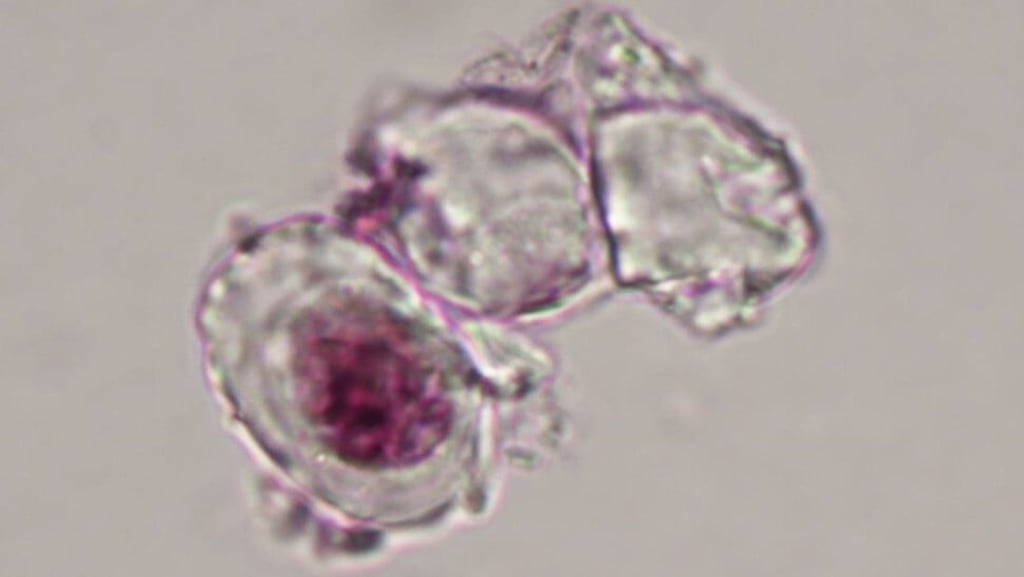 Photographs of three cartilage cells from the femur of Caudipteryx. Photo: Handout