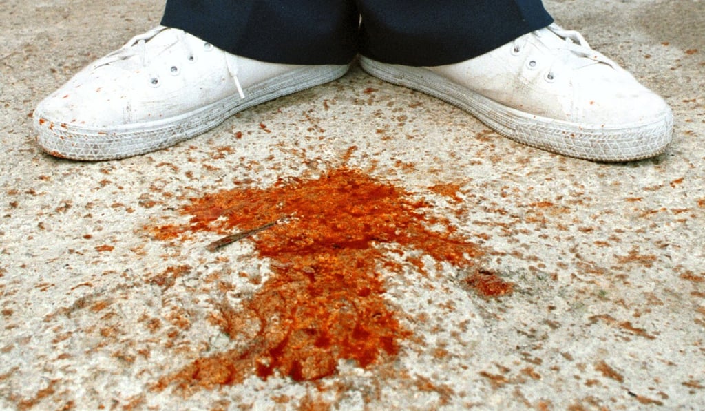 A Taiwanese man spits juices from a mouthful of betel nuts, which are known to cause oral cancer. Photo: AP A Taiwanese man spits juices from a mouthful of betel nuts, which are known to cause oral cancer. Photo: AP
