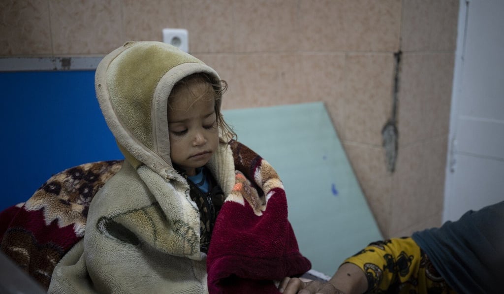 Two-and-a-half-year-old Guldana, who is malnourished, in the Indira Gandhi hospital in Kabul, Afghanistan on November 8. Photo: AP