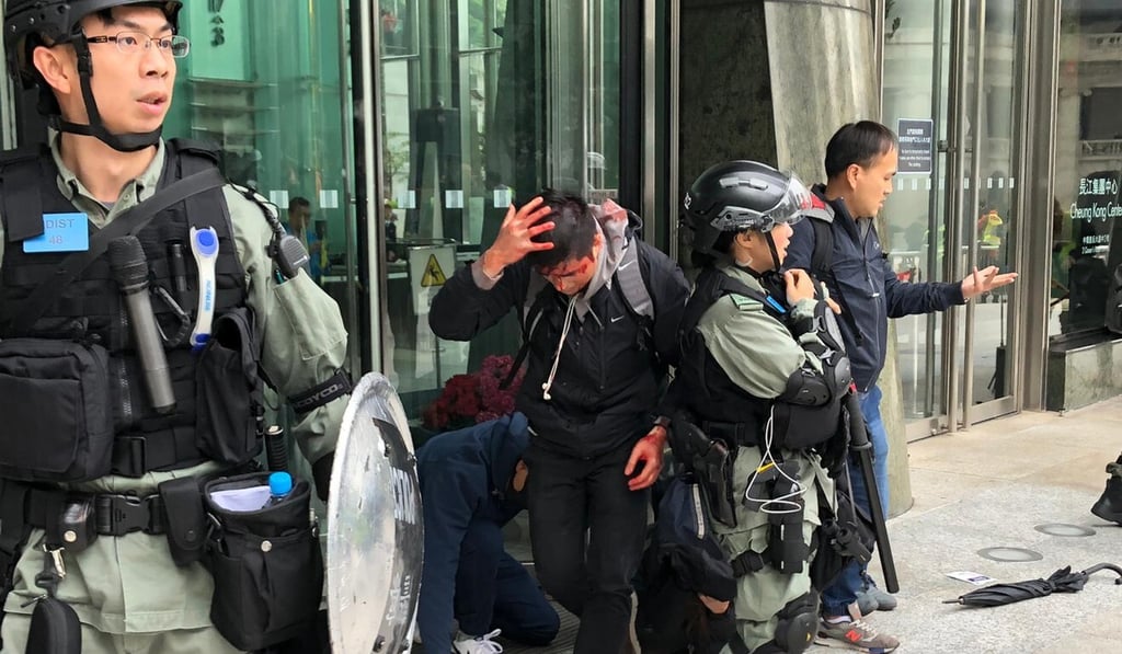 A man believed to be a plain-clothes policeman bleeds from the head after being assaulted following a protest on January 19, 2020. Photo: Alvin Lum A man believed to be a plain-clothes policeman bleeds from the head after being assaulted following a protest on January 19, 2020. Photo: Alvin Lum