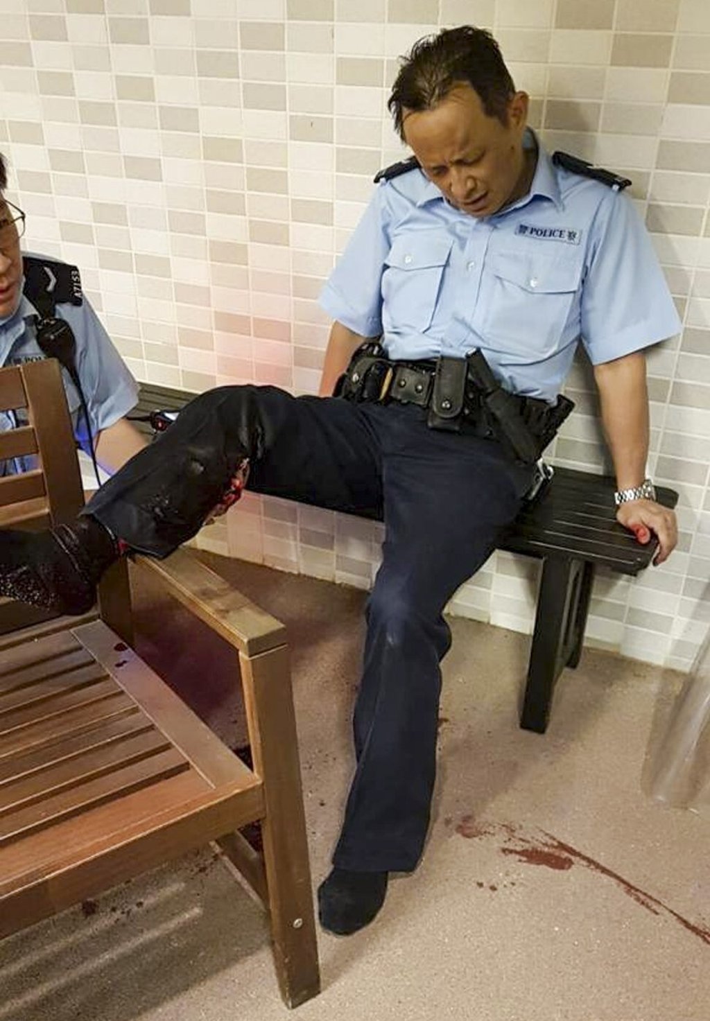 A part-time policeman was knocked down and bitten on the leg in Tin Hau on Wednesday. Photo: Facebook A part-time policeman was knocked down and bitten on the leg in Tin Hau on Wednesday. Photo: Facebook