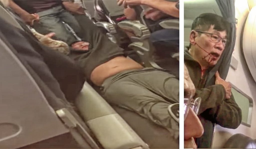 Dr David Dao is dragged down the aisle of United Airlines Flight 3411 by Chicago aviation police on April 9, and then re-emerges with a bloodied jaw. Photo: Twitter