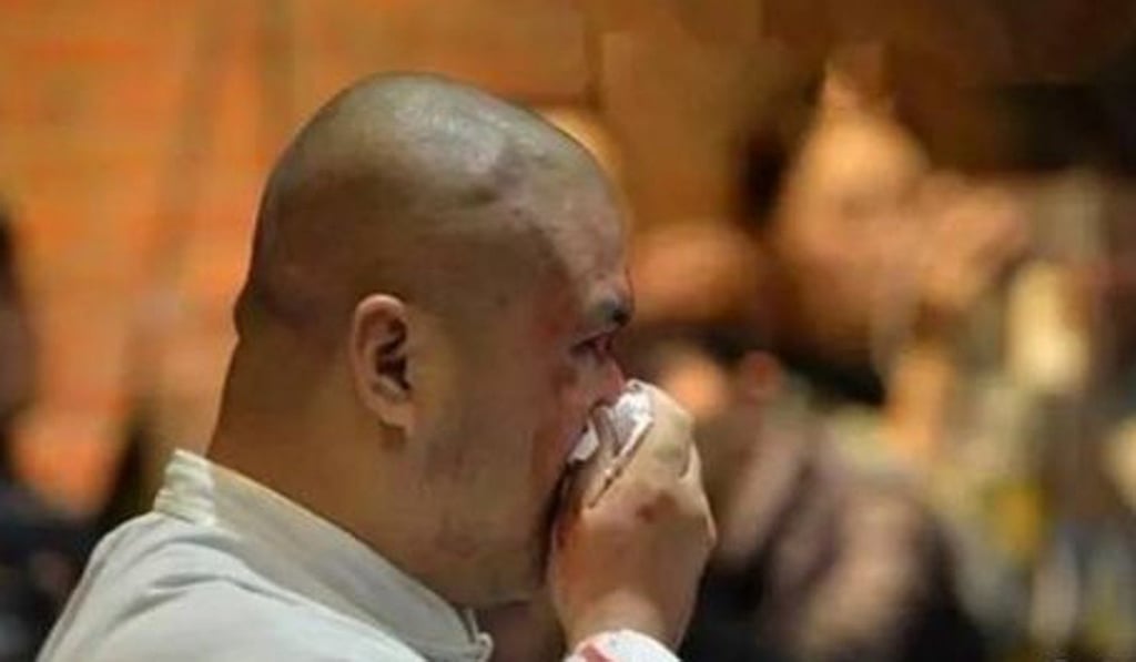 Tai chi ‘thunder master’ Wei Lei nurses a bloody nose after his encounter with MMA boxer Xu Xiaodong. Photo: Handout