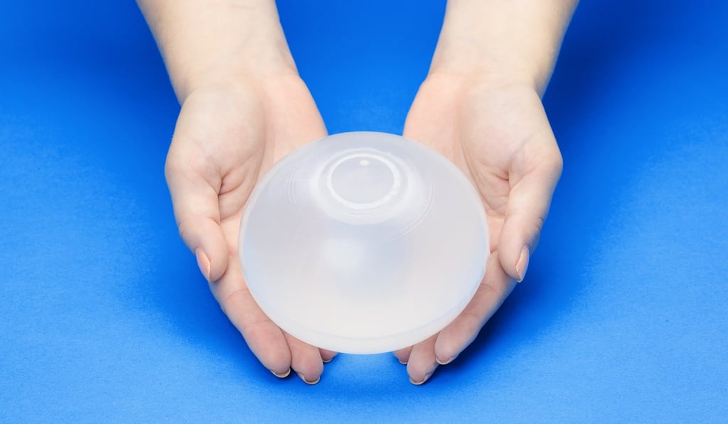An intragastric balloon after inflation. Photo: Allurion Technologies
