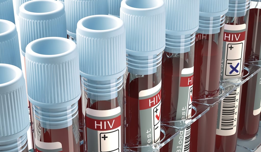 Regular testing is crucial for those at high risk of contracting HIV. Photo: Shutterstock