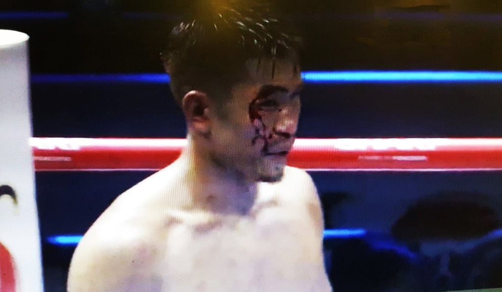 Blood pours down the face of Japan's Sho Kimura during his WBO world title fight against China's Zou Shiming in Shanghai. Photo: Handout