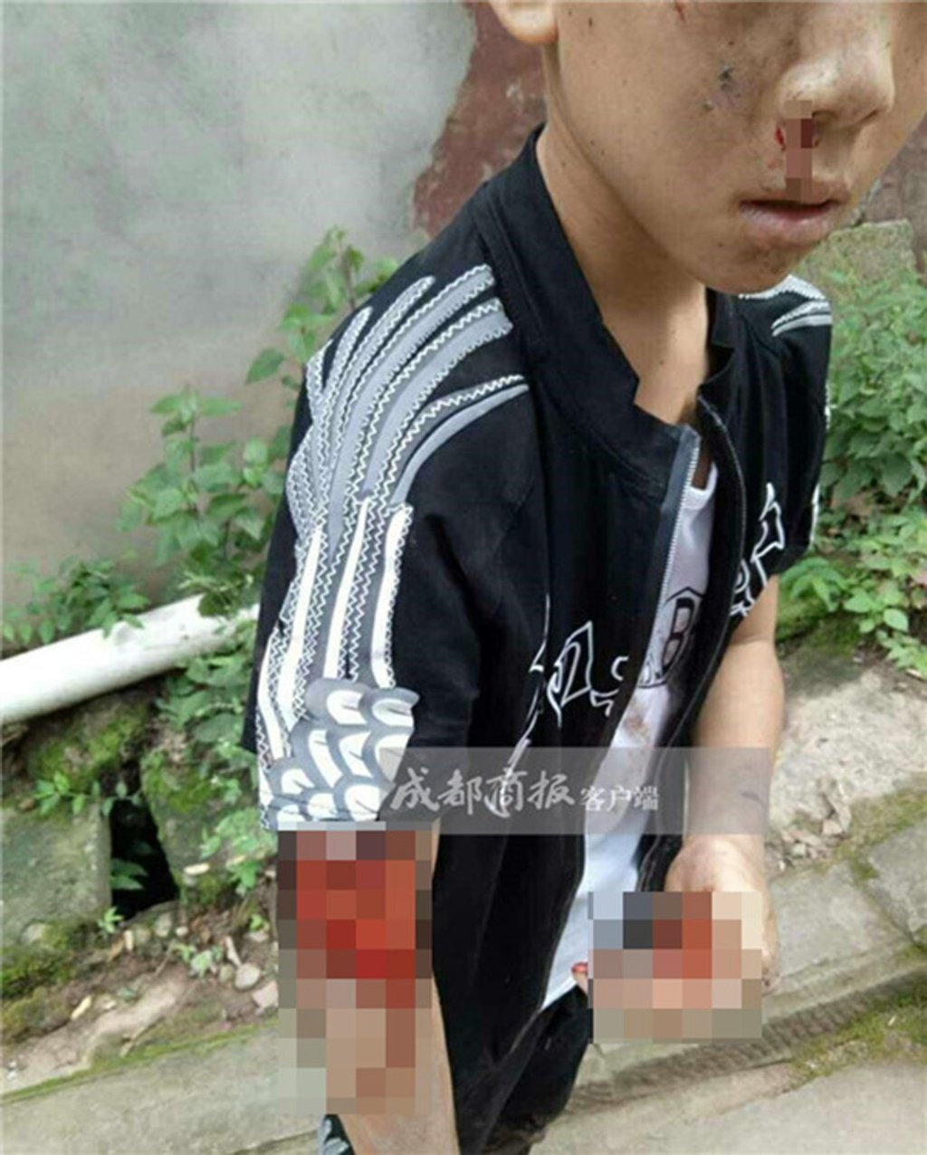 The young boy suffered nasty injuries to his face and arms. Photo: Handout