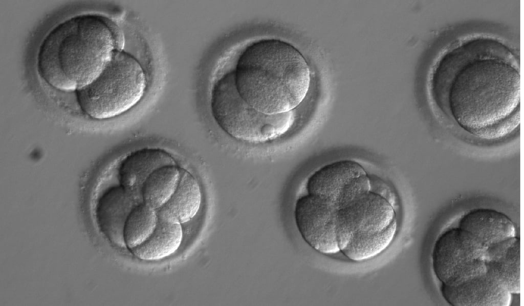 In this microscope photo provided by Oregon Health & Science University, human embryos grow in a laboratory for a few days after researchers used gene editing technology to successfully repair a heart disease-causing genetic mutation. Photo: AP
