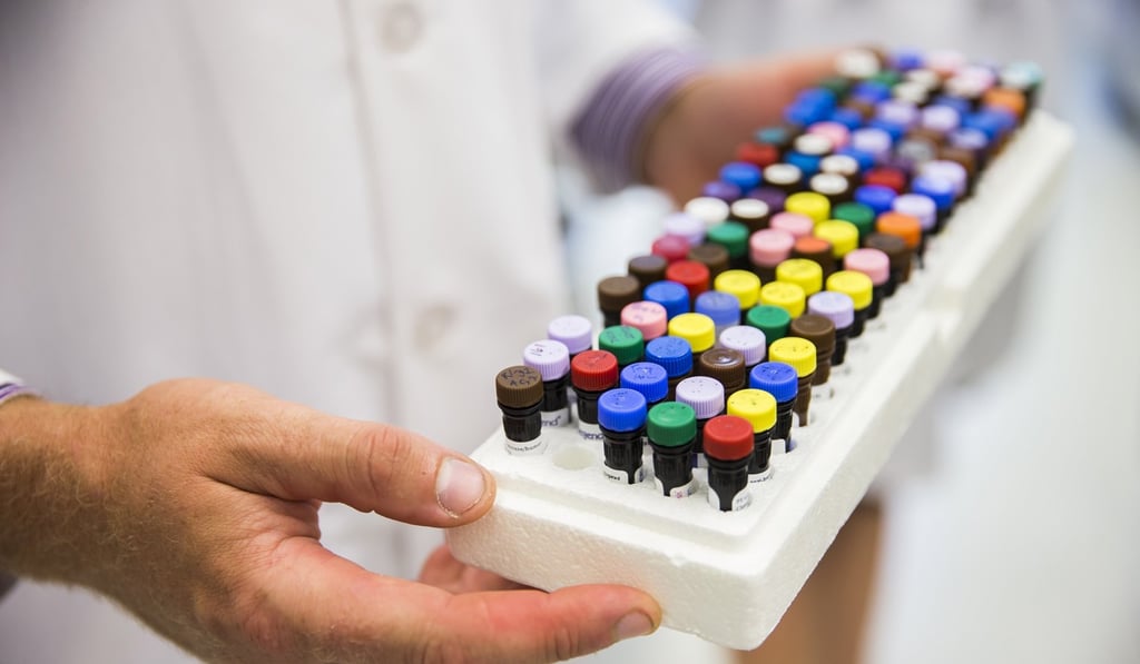 Erik Wambre, molecular biologist and head of the Wambre Lab at the Benaroya Research Institute, holds the markers he used to distinguish human blood cells affected by allergens from normal ones. Photo: TNS