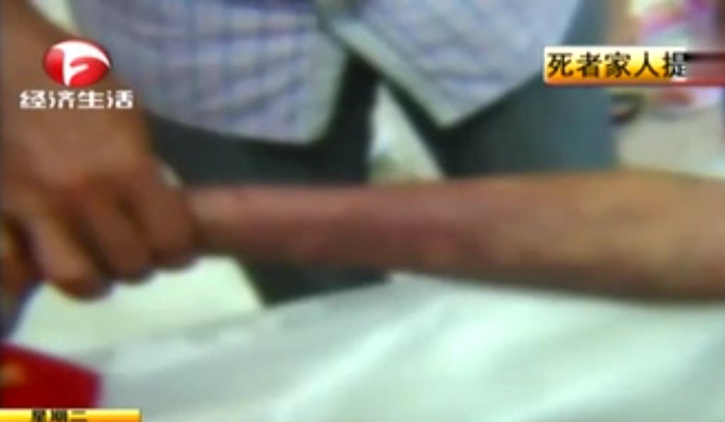 A postmortem examination found the young man had suffered more than 20 external injuries. Photo: Handout A postmortem examination found the young man had suffered more than 20 external injuries. Photo: Handout