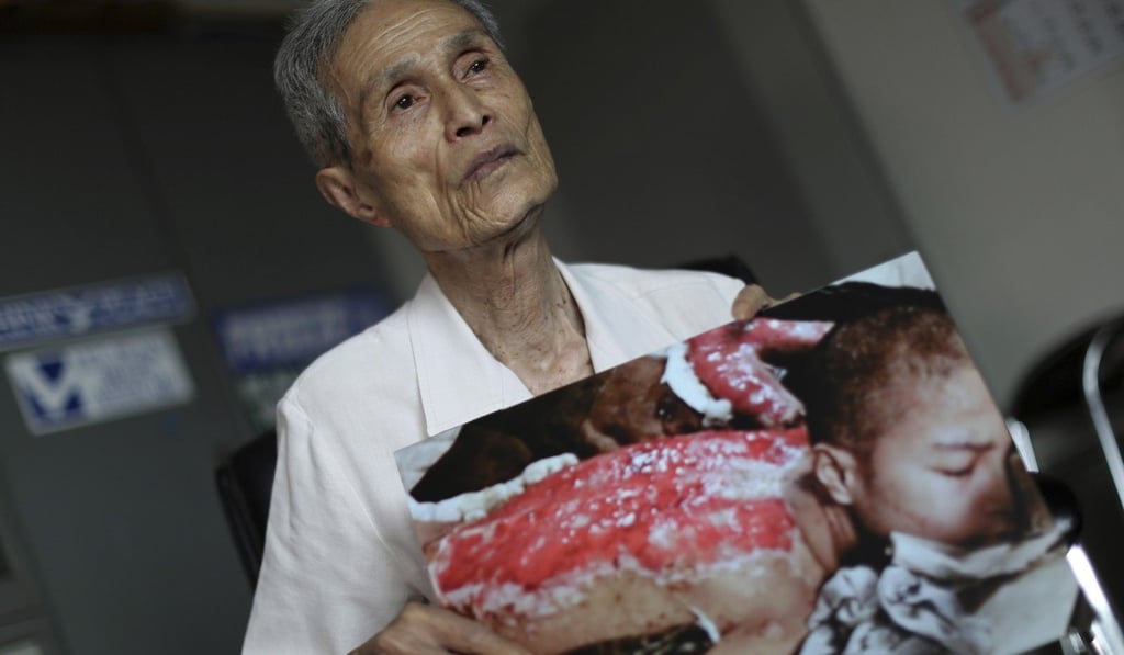 Sumiteru Taniguchi shows a photo of himself taken in 1945. File photo: AP Sumiteru Taniguchi shows a photo of himself taken in 1945. File photo: AP