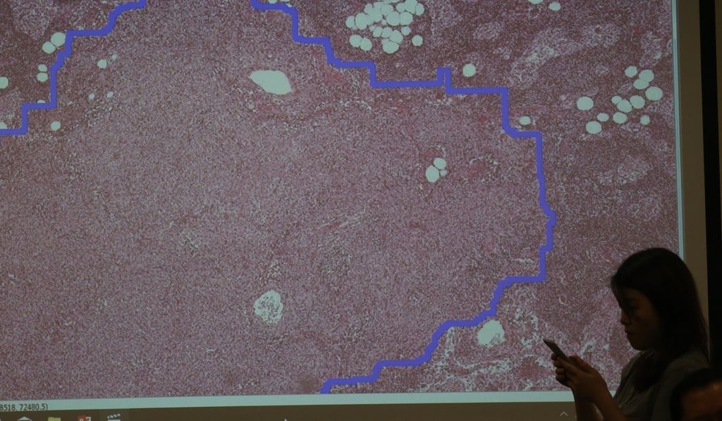 Cells circled by the blue lines are cancer cells identified by the image analysis system. Photo: David Wong