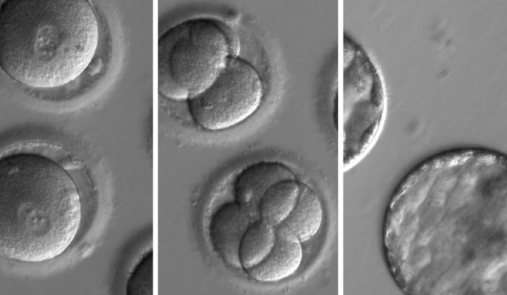 An undated composite handout photo shows a sequence of the development of embryos after co-injection of a gene-correcting enzyme and sperm from a donor with a genetic mutation known to cause hypertrophic cardiomyopathy. Photo: Handout via EPA