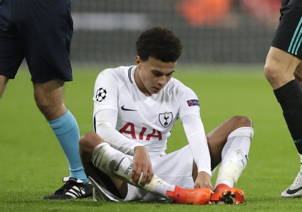 Tottenham’s Dele Alli is also unable to report for England duty. Photo: AP