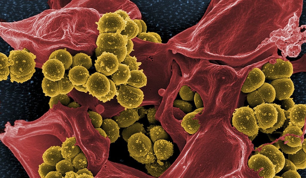 A close-up of Methicillin-resistant Staphylococcus aureus, which has been shown to contribute to several kinds of infections in humans that are difficult to treat. Photo: US National Institutes of Health/Department of Health and Human Services
